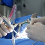 PainTEQ LinQ Sacroiliac Joint Fusion